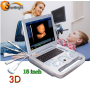 Fábrica de escáner de ultrasonido digital portátil en blanco y negro completamente digital doppler de alta calidad en China