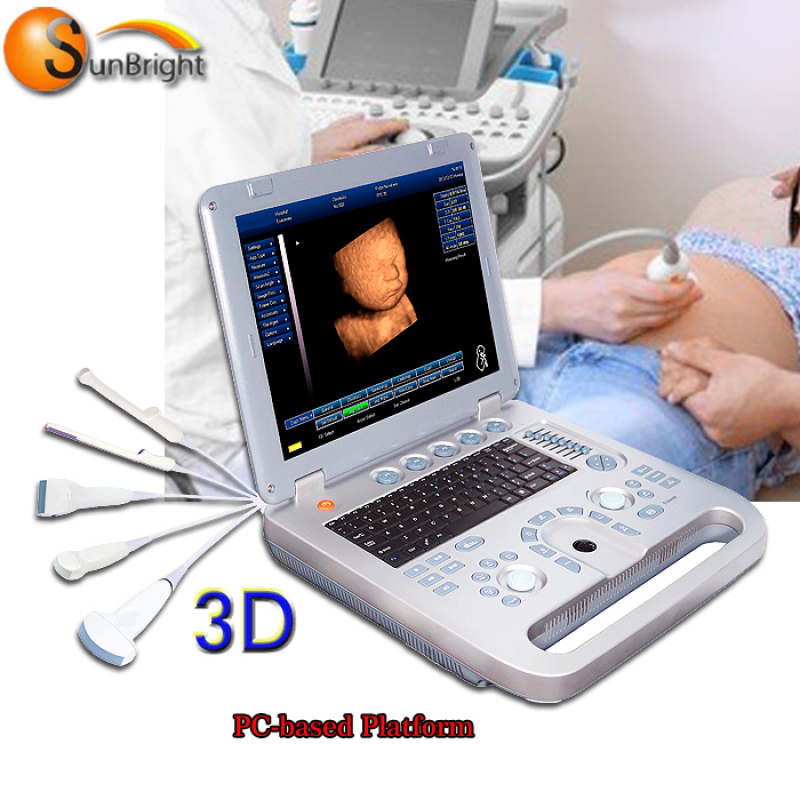 Real manufacturer portable ultrasound 2d echo machine