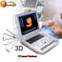 Real manufacturer portable ultrasound 2d echo machine