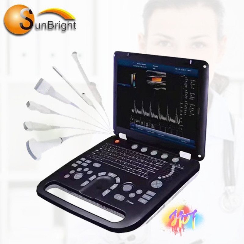 OB fetal image color doppler 3d 4d portable color Doppler ultrasound machine