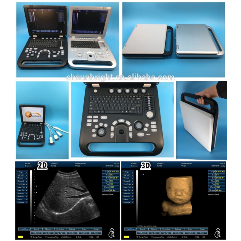 Portable laptop style Medical ecografo 3D 4D ultrasound scanning machine for hospitals