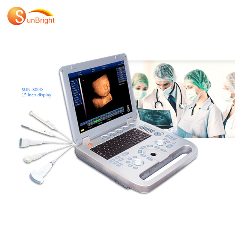 Real manufacturer portable b 3d ultrasound scanner machine cases machine