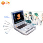 Real manufacturer portable b 3d ultrasound scanner machine cases machine