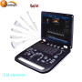 High end digital Cardiac Vascular 4d ultrasound scanner color doppler