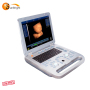 Portable medical great performance handheld ultrasound 3D function