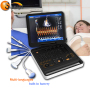 Doppler Vascular Machine Full Digital Echo cardiology color Doppler Ultrasound Portable