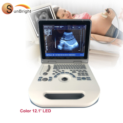 Vet Use Pig Sheep Ultrasound Veterinary USG Laptop Veterinary Ultrasound Device