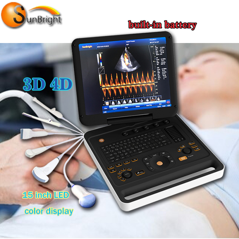 Macchina portatile per laptop con flusso sanguigno ecografico color Doppler ecografo 3D per grande vendita
