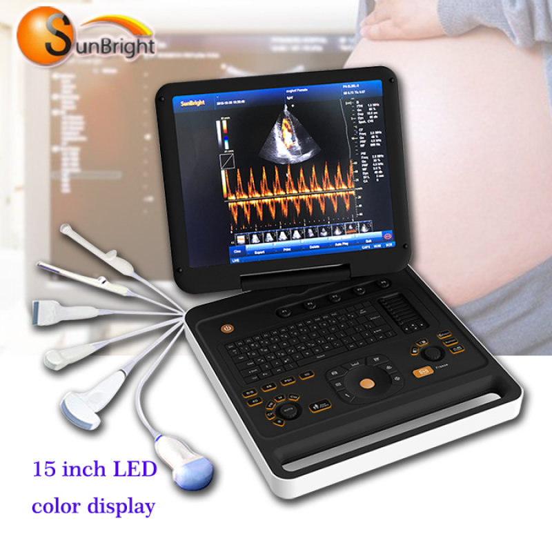 high quality portable laptop medical cardiac 2d echo color doppler ultrasound equipment