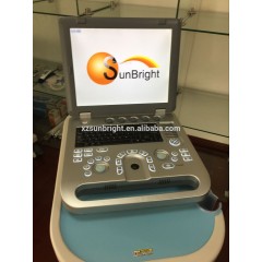 15 inch color display 2D 3D laptop ultrasound machine for pregnant women testing