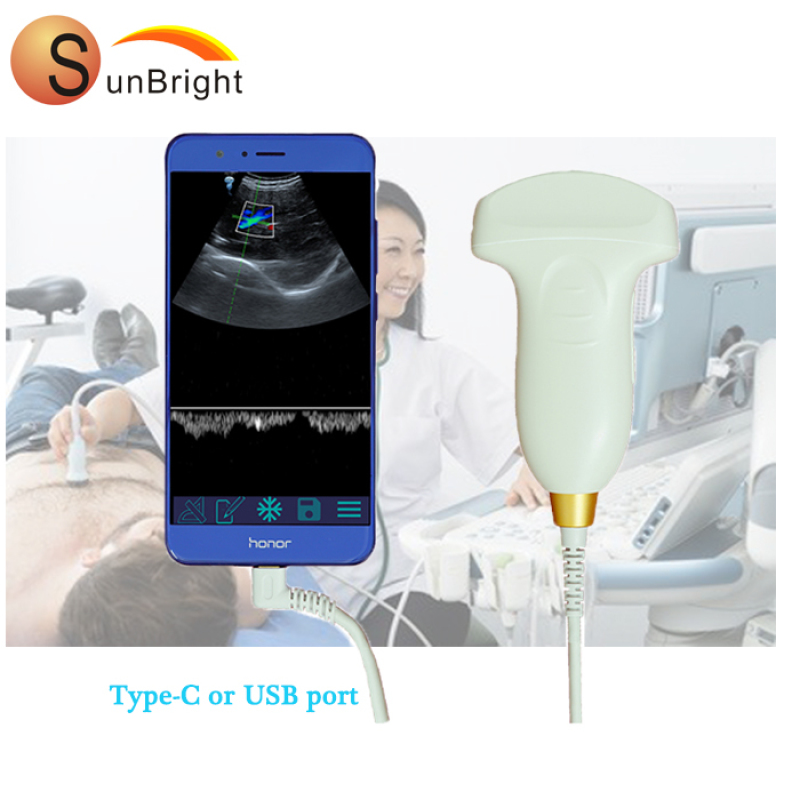 high intensity digital portable medical USB ultrasound probe scanner wifi ultrasound probe
