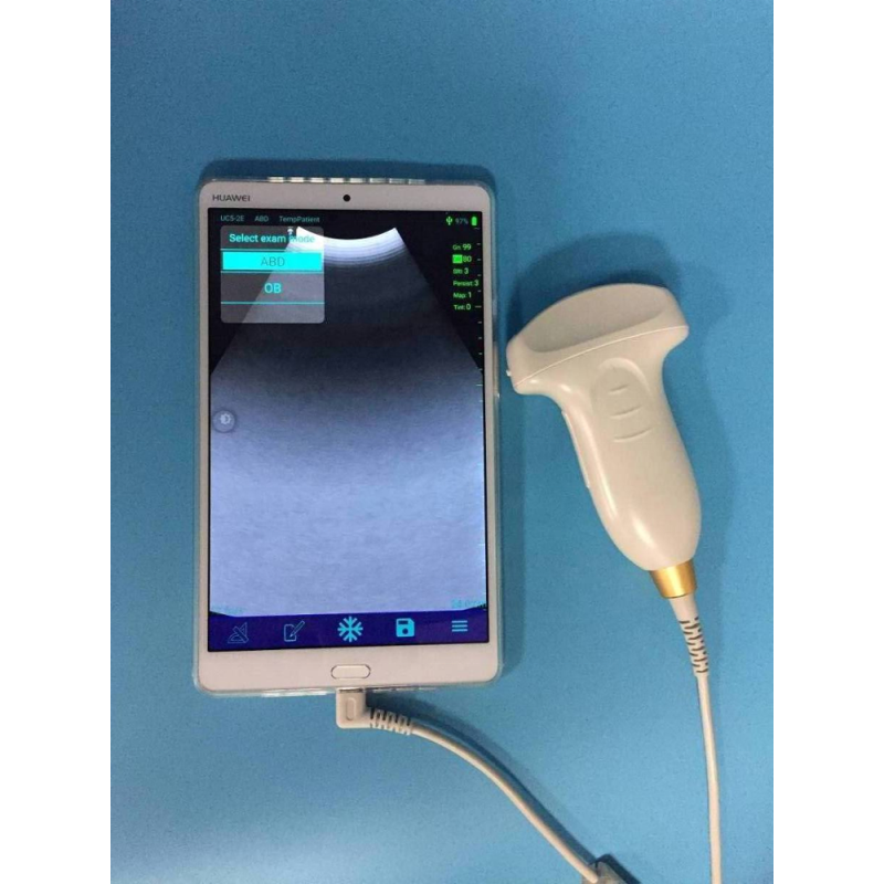 Big sale!!! Handheld USB convex probe mini ultrasound wireless probe