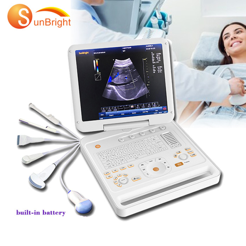 cardiac doppler 3D laptop cardiac vascular pregnancy ultrasound doppler price