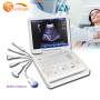 cardiac doppler 3D laptop cardiac vascular pregnancy ultrasound doppler price