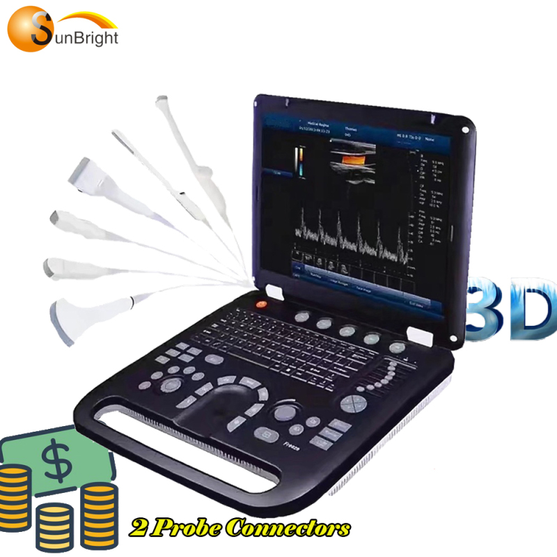 SUN-906A رخيصة الطبية المحمولة الموجات فوق الصوتية لون دوبلر الماسح 4d / 5d آلة الموجات فوق الصوتية للحمل