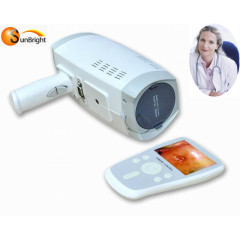 best price colposcopy machine digital video colposcope