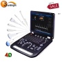 medical equipment 3D 4D Obstetrics color doppler ultrasound price
