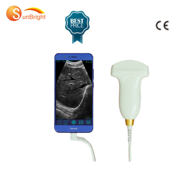 Small size pocket ultrasound system Type C convex probe cheap price sunbright ultrasound probe