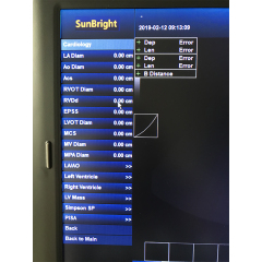 Well sold high end affordable 4D 192 elements color Doppler sunbright ultrasound scanner