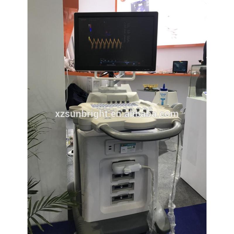 Machine à ultrasons Doppler couleur à injection guidée par ultrasons stationnaire 4D CW à chariot Doppler 4d