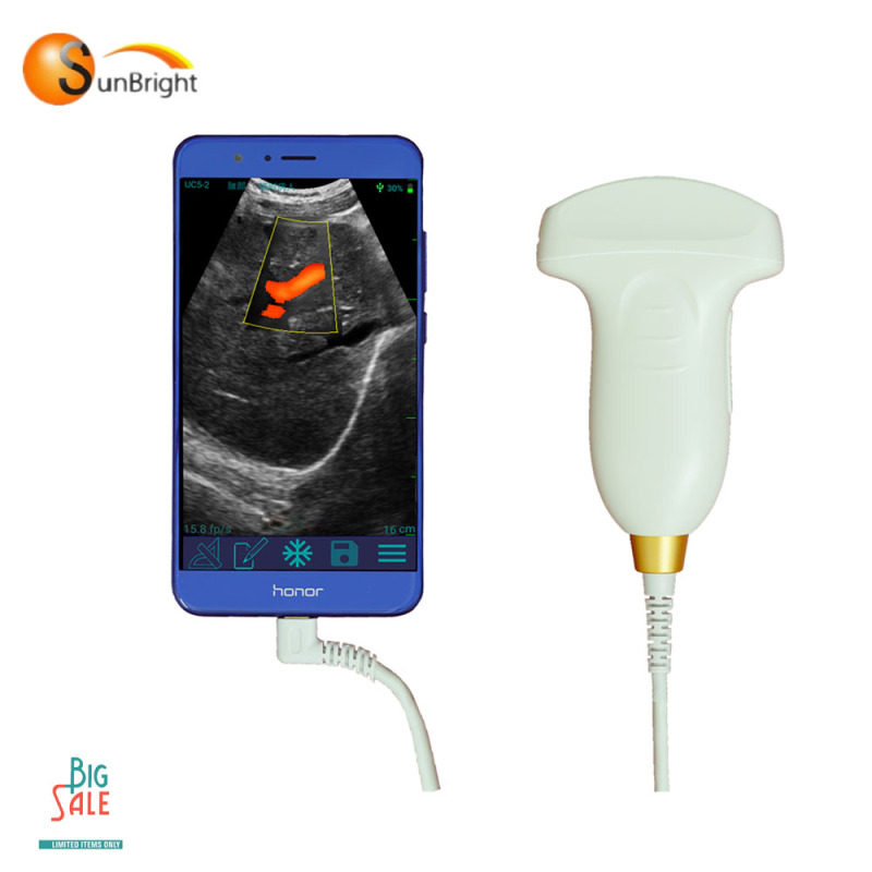 portable iphone ultrasound probe excellent probe impressive