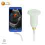 portable iphone ultrasound probe excellent probe impressive