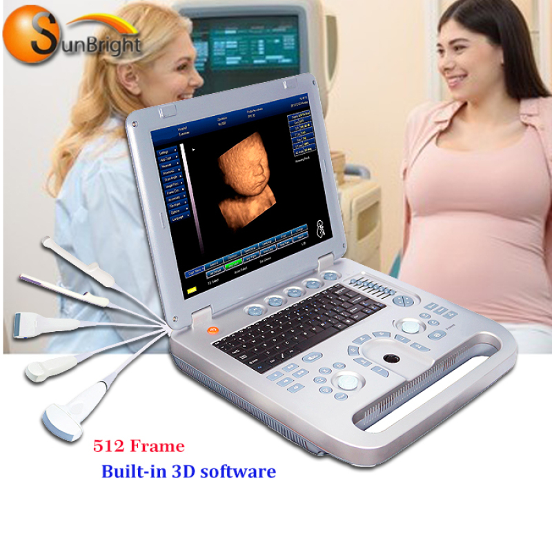 15inches 3D Laptop heiße verkaufende Ultraschall-Scanner-Krankenhausmaschine für Schwangerschaft