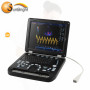 Portable 3D/4D Color Doppler Ultrasound System USG Color Doppler ultrasound device