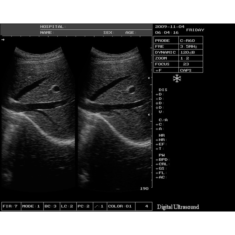 Hot sale 12.1 inch Laptop ultrasound scanner price of sonography machine