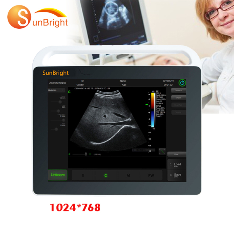 Volldigitales mobiles günstiges tragbares Herz-Ultraschallgerät mit Touchscreen, Ecografo-Preis