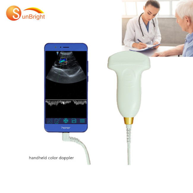 2020 product ideas convex android ultrasound probe diagnostic system for sale