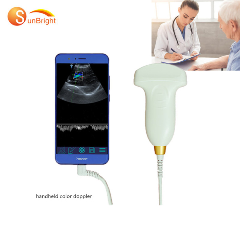 2020 idées de produits système de diagnostic de sonde à ultrasons android convexe à vendre