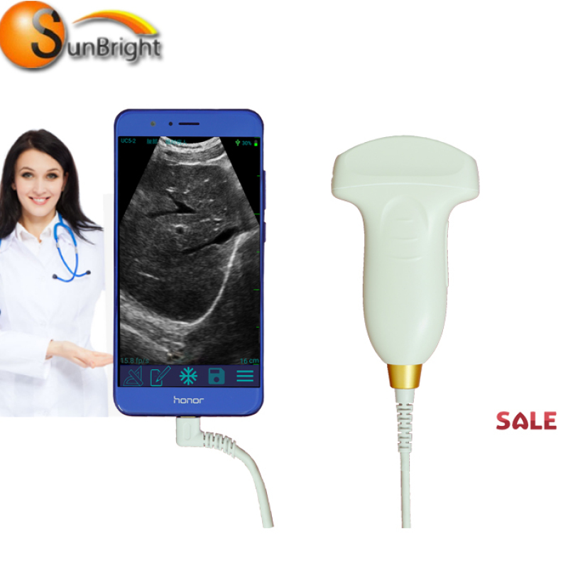 Factory Price Portable USB Convex ultrasound Probe Type-C USB Transducer For Laptop