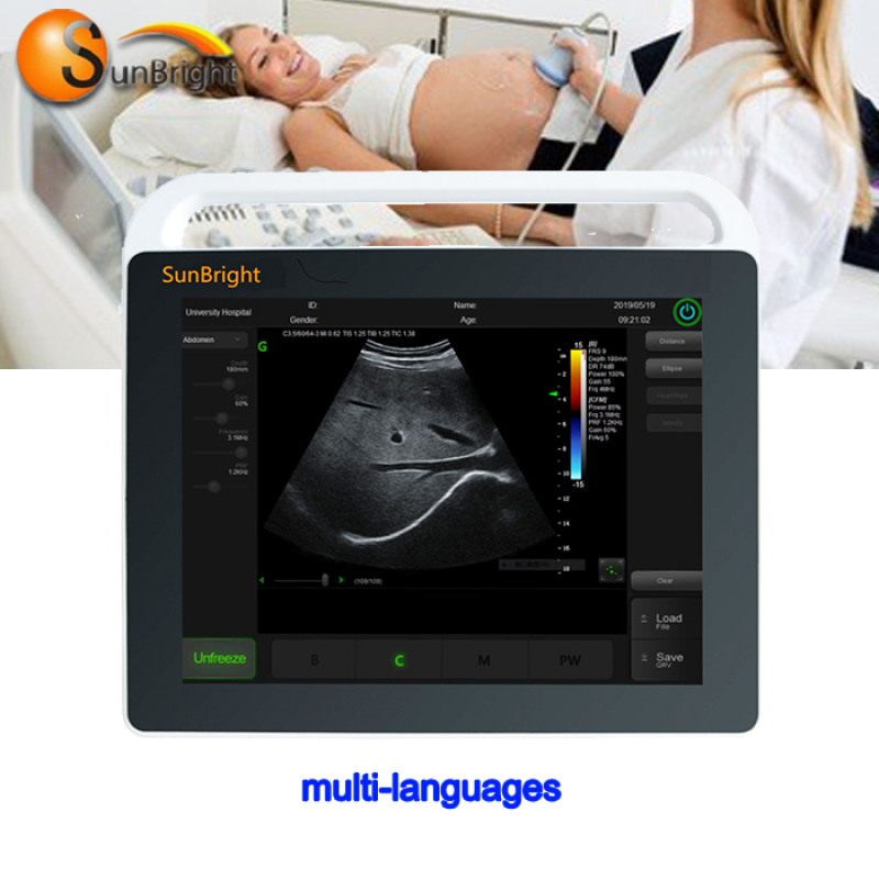 15-Zoll-Touchscreen-Ultraschall tragbarer Laptop-Ultraschall-Echo-Ultraschallscanner