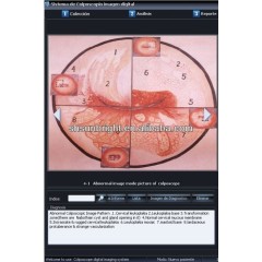 Digital Video Vagina Colposcope for Gynecology