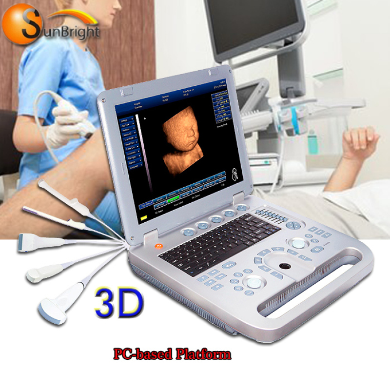 다목적 발전기 초음파 스캐너 기계 인간 또는 수의학 휴대용 초음파 기계