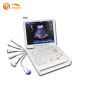 Portable 3D/4D CW CE SUN-906C Portable mindray color ultrasound portable doppler good quality