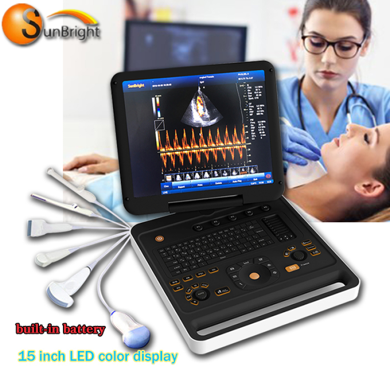 Hot sale Sunbright 3D 4D Color Doppler ultrasound machine portable ultrasound with PW function