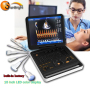 Hot sale Sunbright 3D 4D Color Doppler ultrasound machine portable ultrasound with PW function