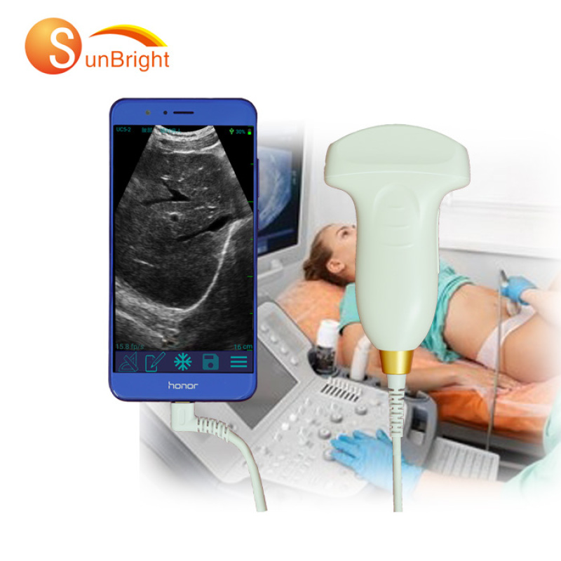 high resolution best sale medical portable USB connected ultrasound usb scanner focused equipment