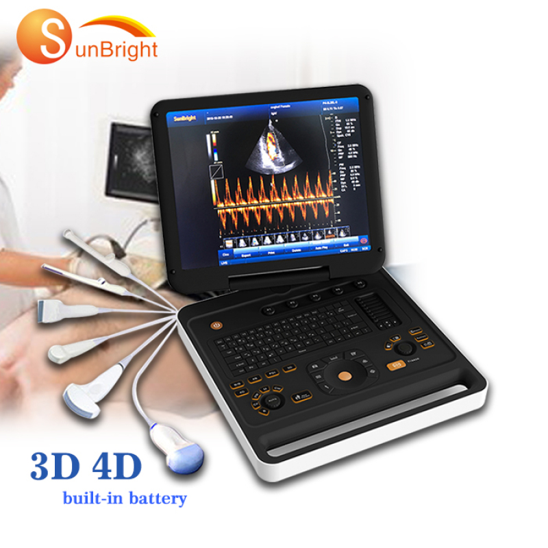 laptop 3D digit PW color Doppler medical ultrasound hospital equipment