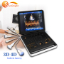 laptop 3D digit PW color Doppler medical ultrasound hospital equipment