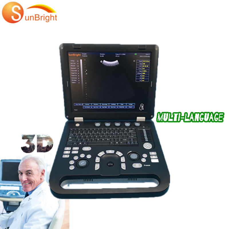 Immagine 3D di alta qualità medica per ecografo ostetrico ginecologico cx50