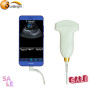 USB color Doppler convex Probe Scanner sonda lineare per ecografo portatile