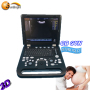 Factory price Portable ultrasound scanner price 3d portatil eco ultrasonography machine