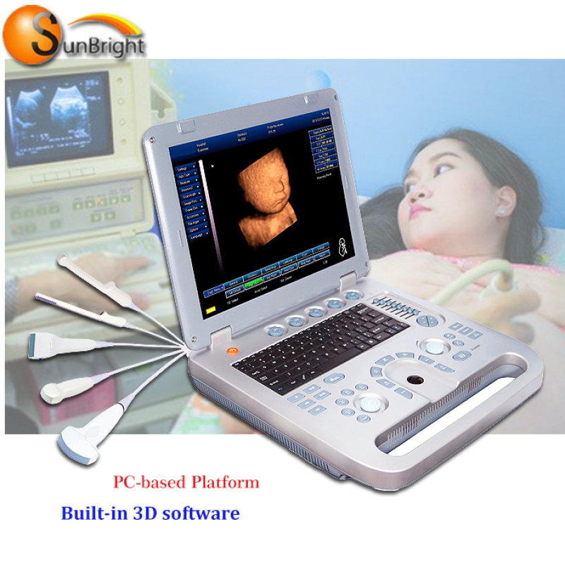 Factory Low Price Portable Laptop 3D Ultrasound Scanner Machine ultrasound