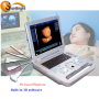 Factory Low Price Portable Laptop 3D Ultrasound Scanner Machine ultrasound