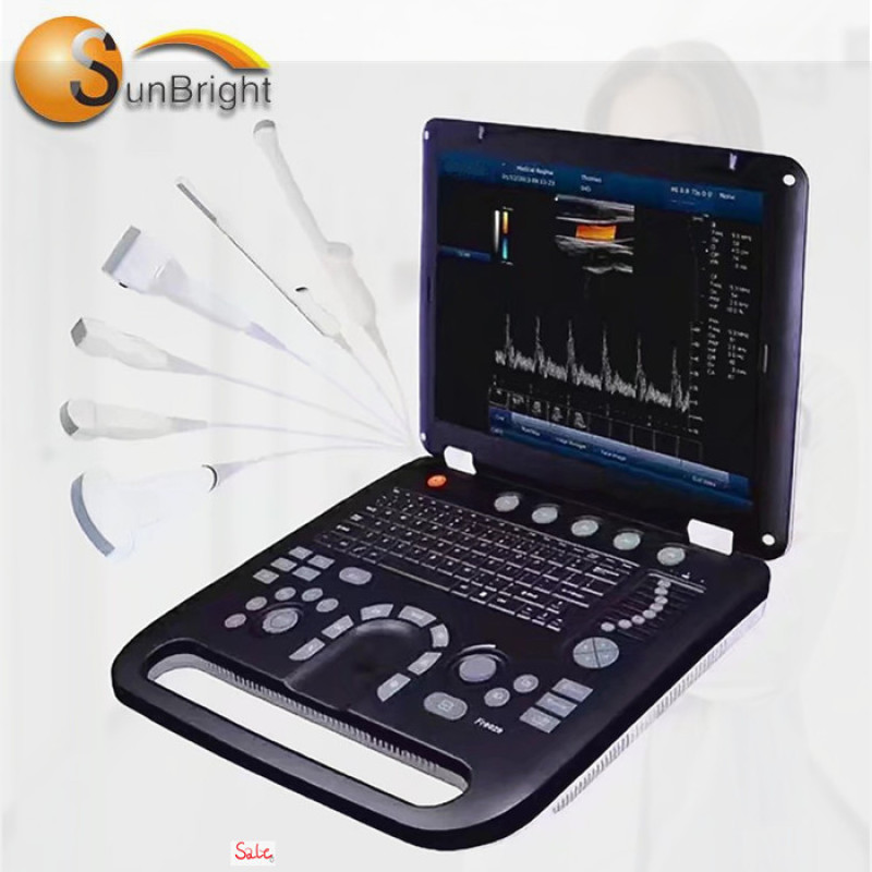 Similar or better than sonoscape ultrasound portable cheap 3D color Doppler device