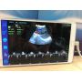 factory price portable USB probes ultrasound color doppler probe