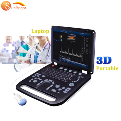 Ultrasound system color doppler 3d ultrasound 4d color doppler ultrasound price